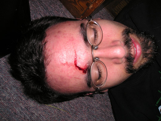 Jeffie did that to him...